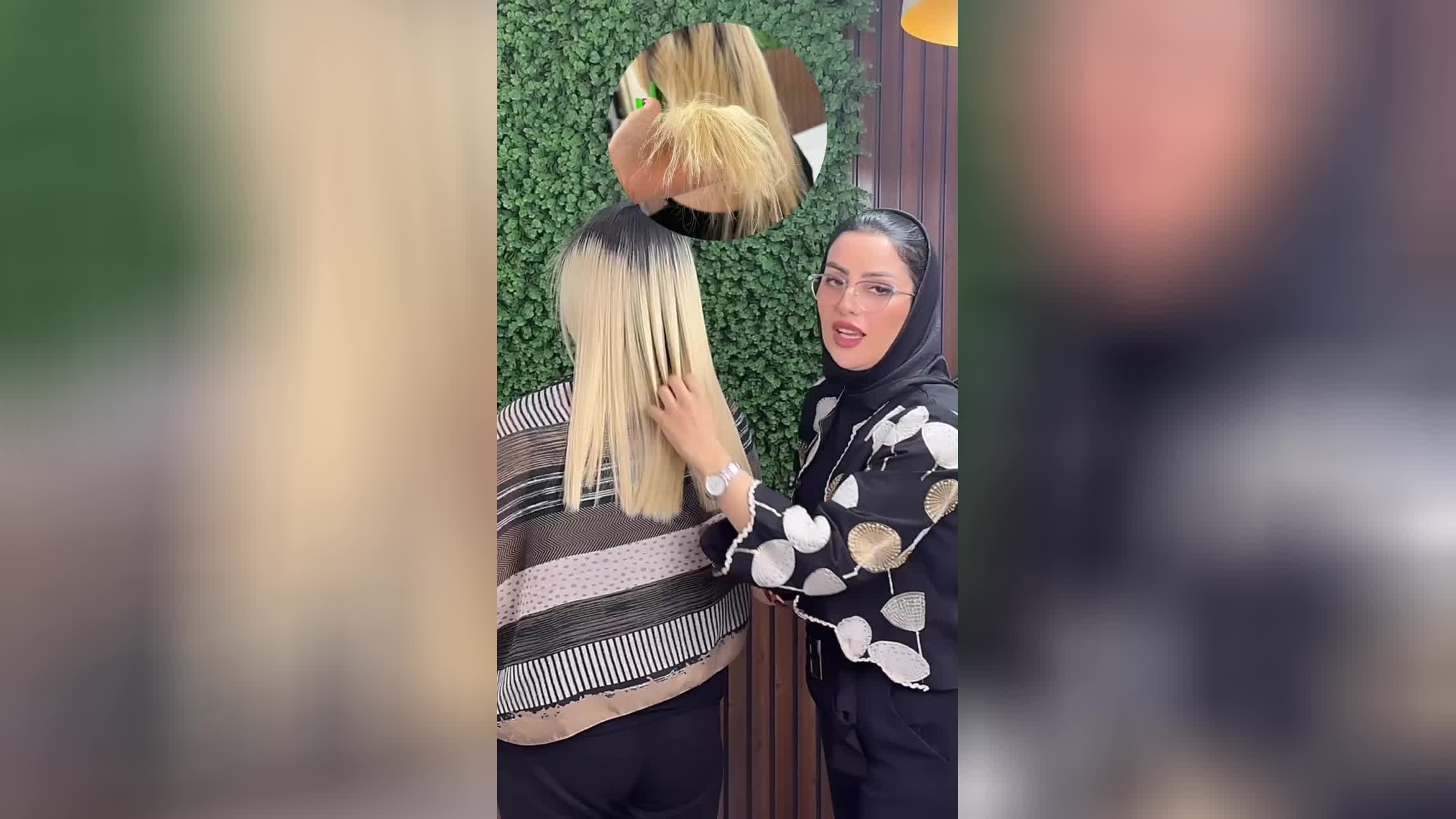 میکروبلیدینگ و شیدینگ لب در فلاح و ابوذر تهران